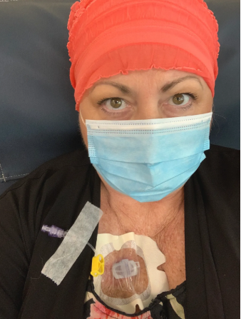 70 Staples Devil and the Drip